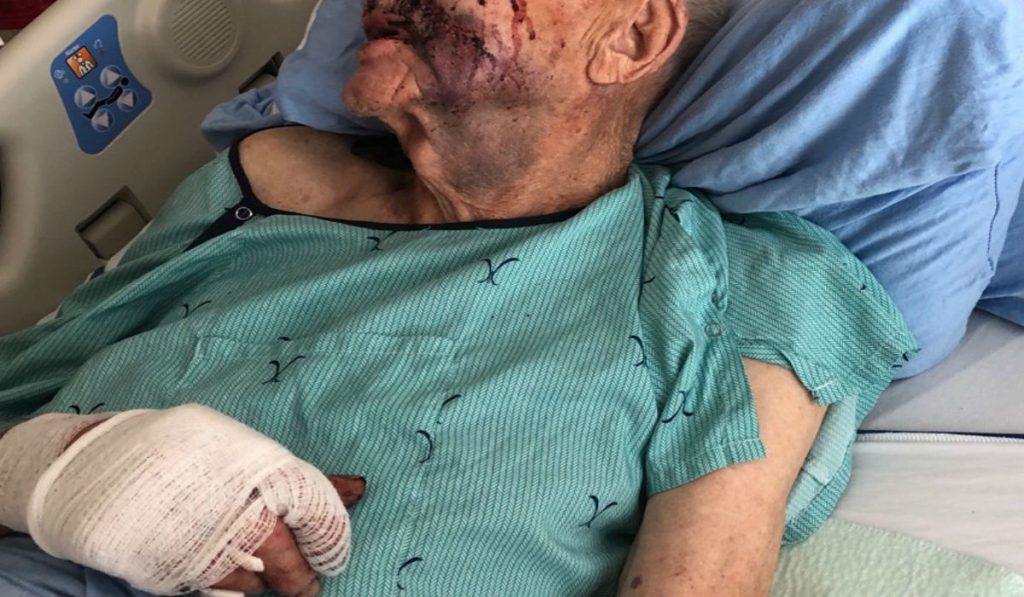 Fundraising effort underway for 89-year-old man injured in Courtenay machete attack